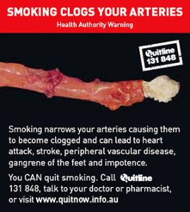 SMOKING CLOGS YOUR ARTERIES