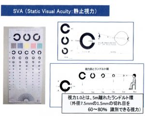 SVA(静止視力検査)