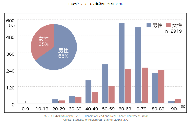 口腔がん発症年齢