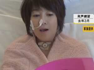 舌がん手術後の発声練習