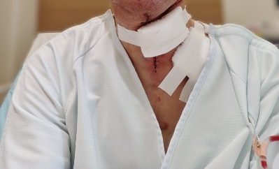 手術翌日