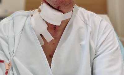 手術翌日