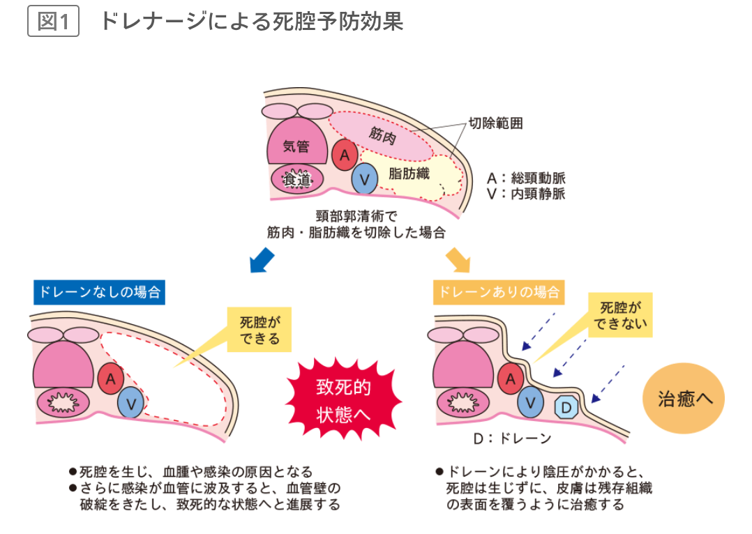 イメージ図