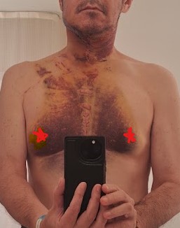 退院時の状況①